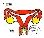 콘돔