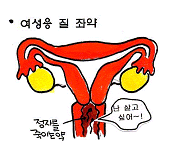 피임용 질 좌약(=질정제)